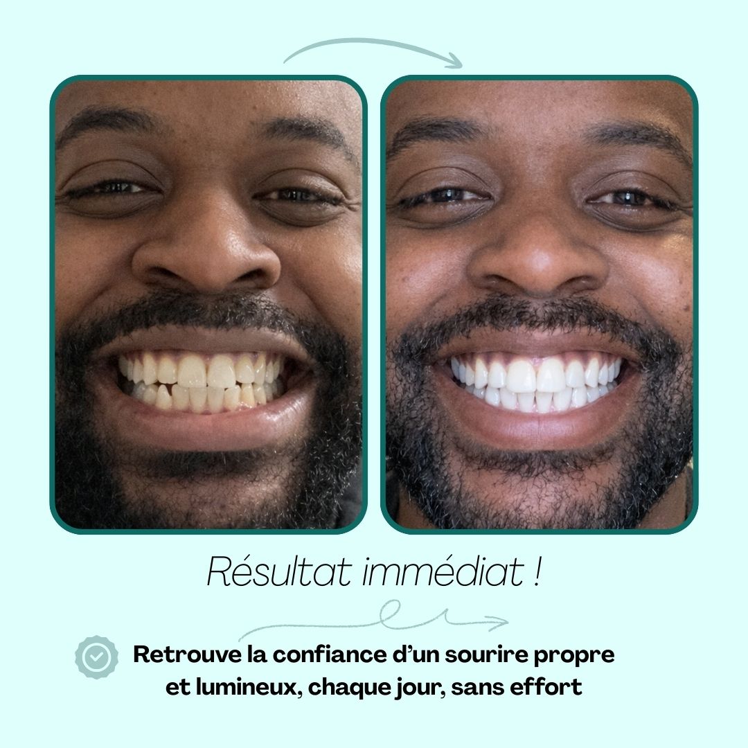 Brosse à Dents Ultrasonique