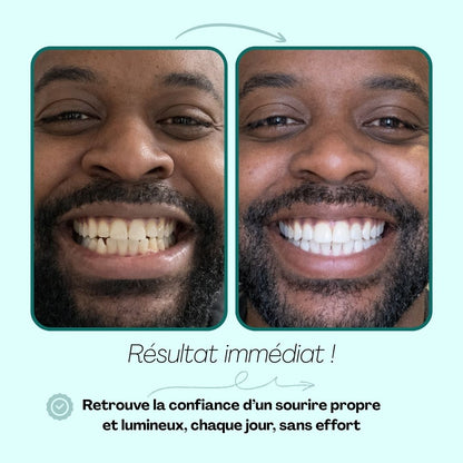 Brosse à Dents Ultrasonique